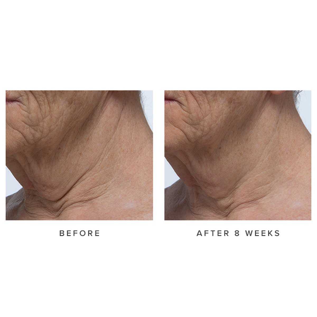 Ageless Revitalizing Neck Cream Neck Cream for Daily Skin Care and Mature Skin Care