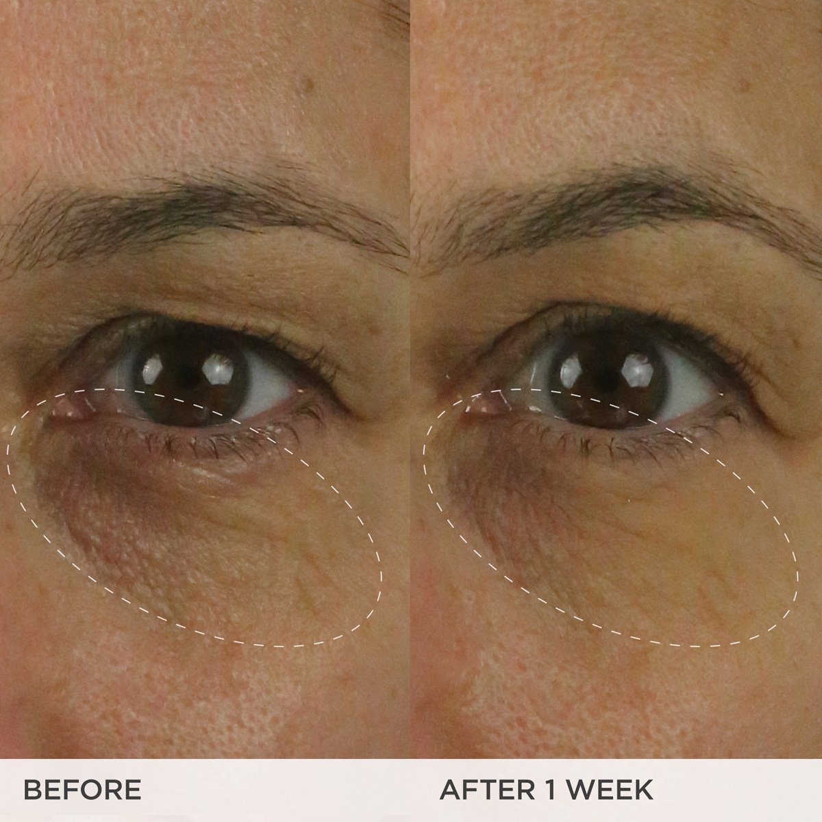 The Brightening Eye Cream Eye Cream for A Range of Skin Types and Radiance Support