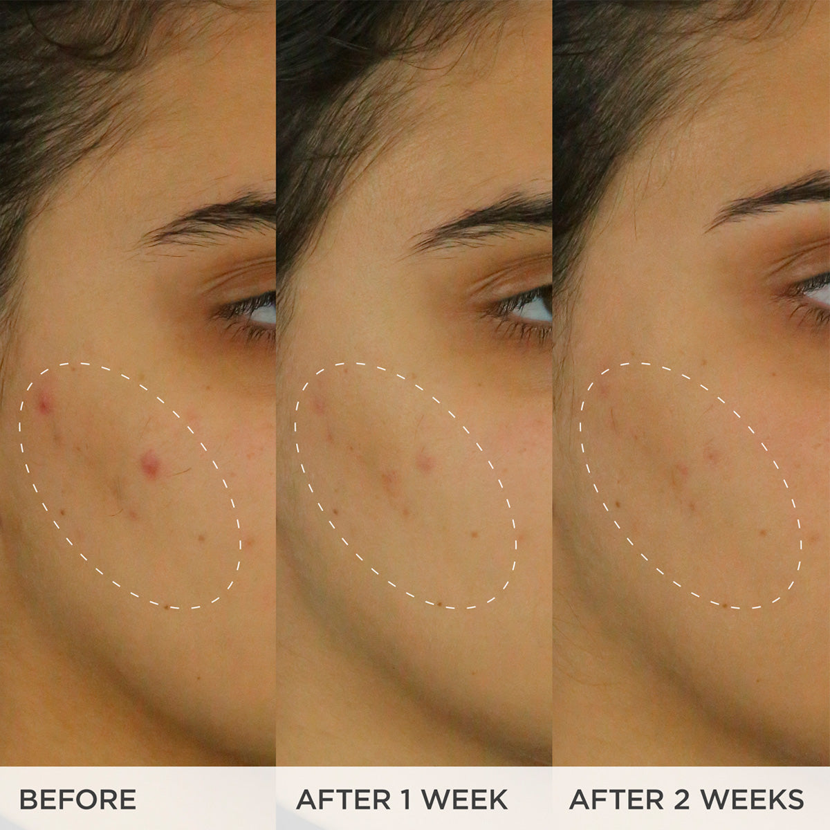 The Brightening Serum Face Serum for A Range of Skin Types and Radiance Support