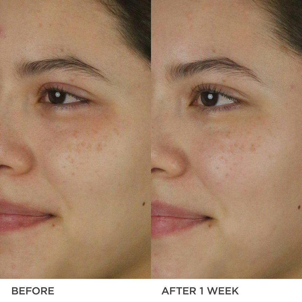 The Dewy Milk Moisturizer Face Moisturizer for Combination to Oily Skin and Moisture Support