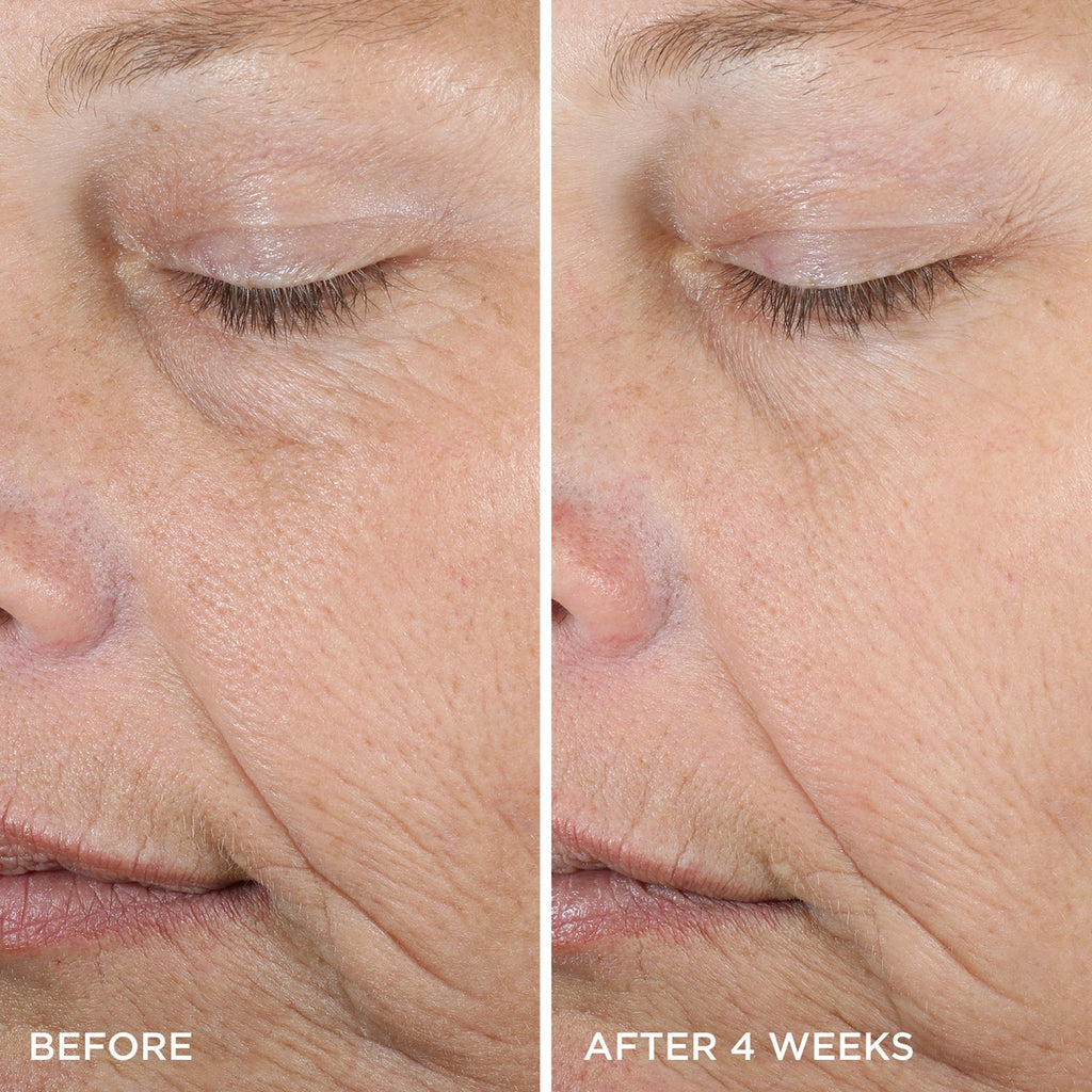 The Dewy Serum Face Serum for A Range of Skin Types and Moisture Support