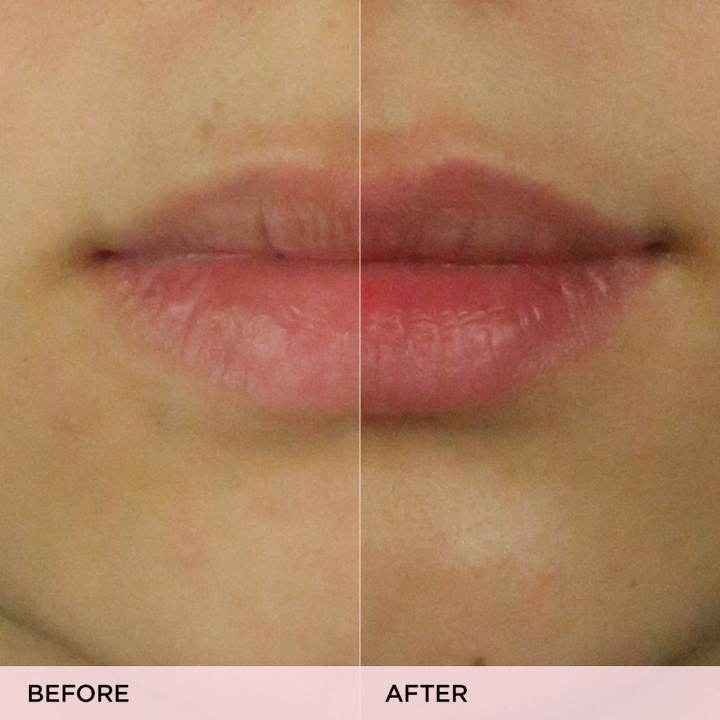 The Kissu Lip Scrub Lip Scrub for Daily Skin Care and Even Texture