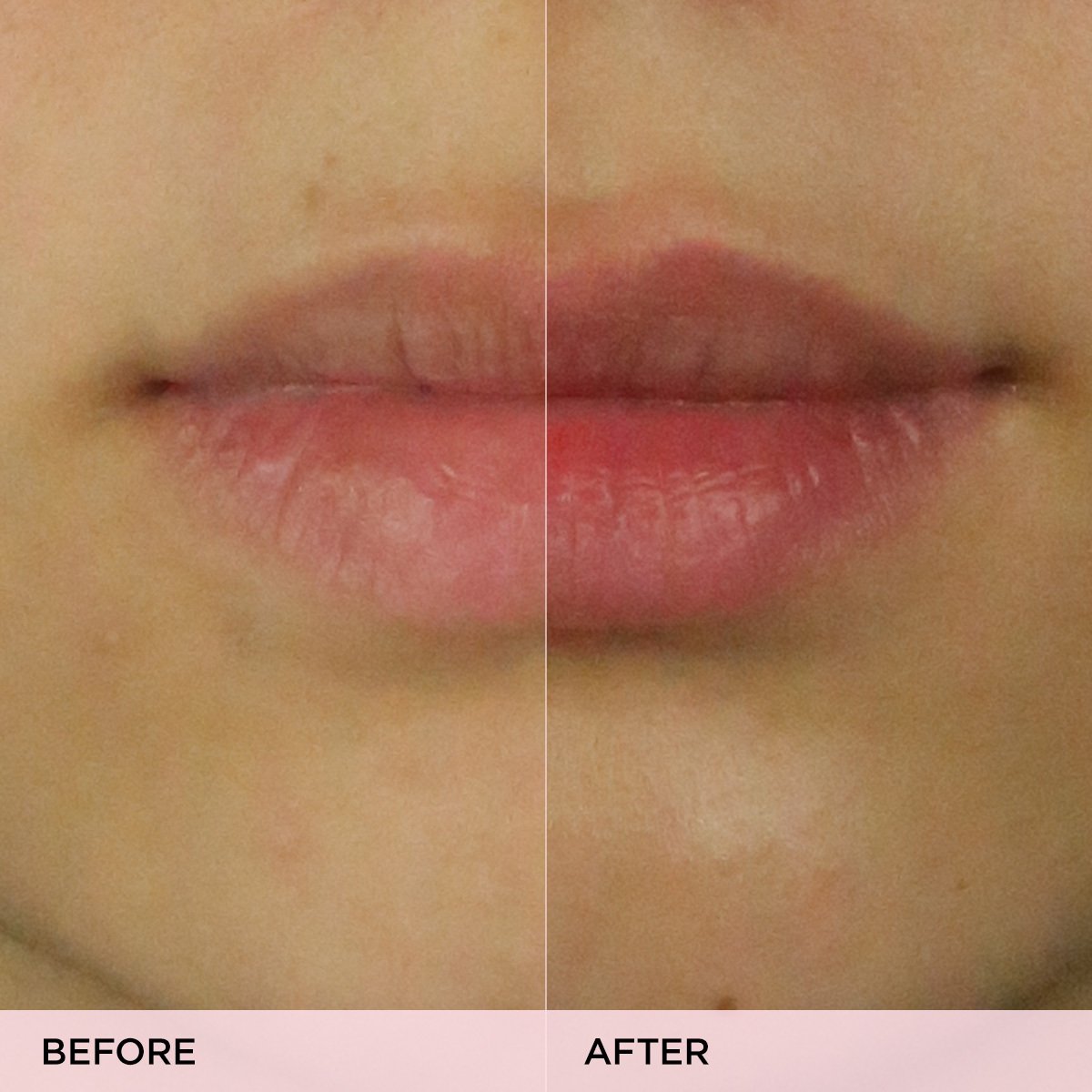The Kissu Lip Scrub Lip Scrub for Daily Skin Care and Even Texture