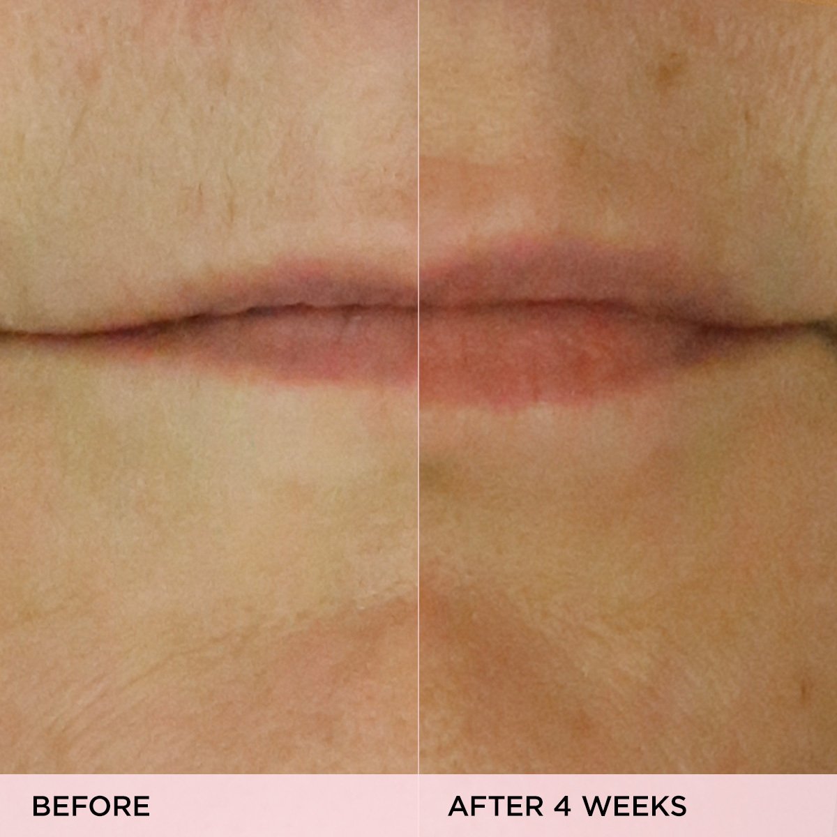 The Kissu Lip Treatment Lip Care for Daily Skin Care and Smooth Looking Skin