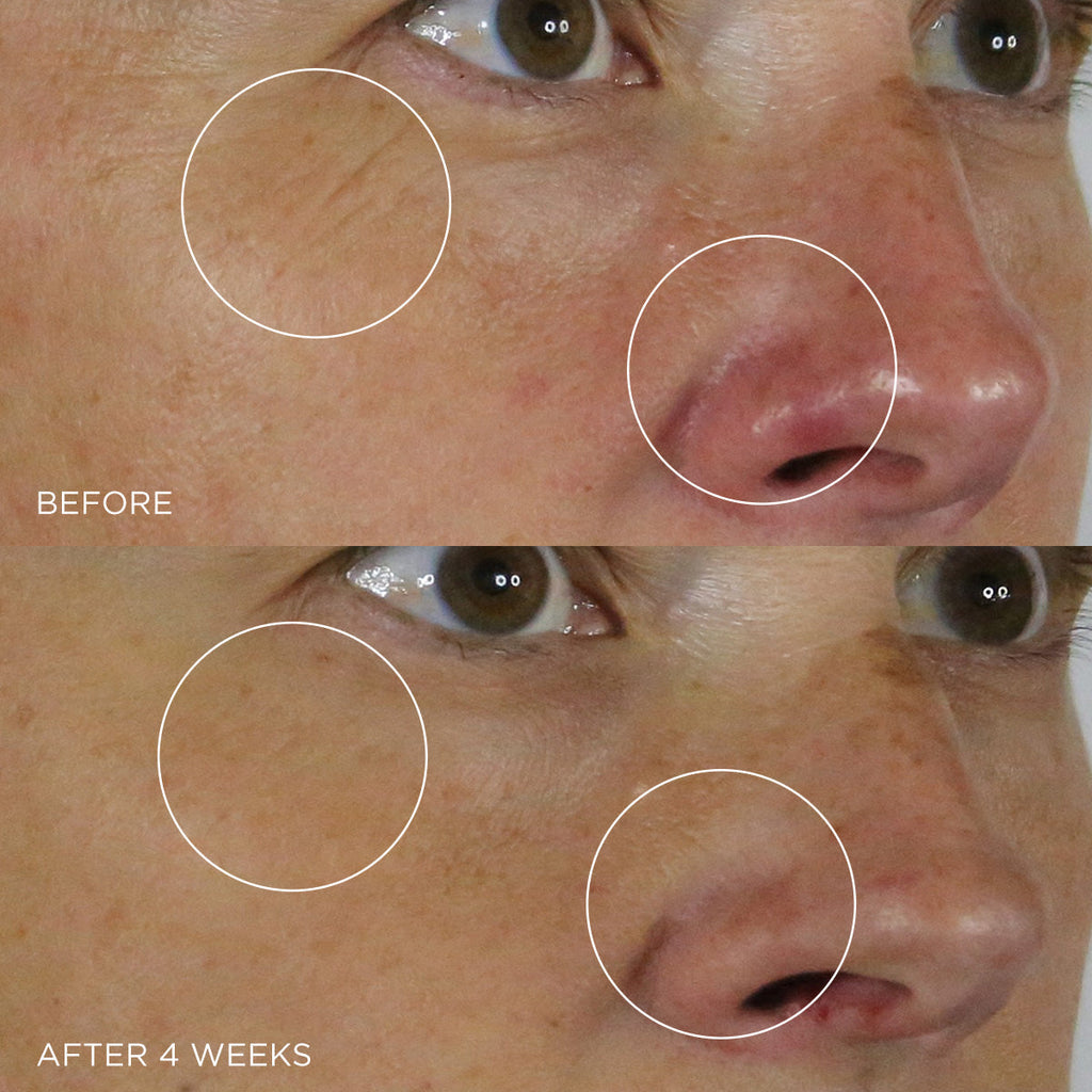 The Silk Serum Face Serum for Daily Skin Care and Mature Skin Care